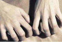 警惕更年期综合症带来的危害