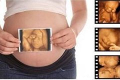 四维彩超那么贵不懂这些就白做了？