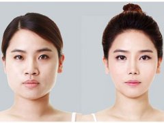 别盲目尝试！5个瘦脸误区要警惕？