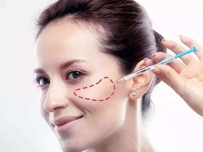 注射苹果肌后应该如何护理？