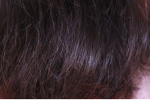 修复头发的方法有哪些？