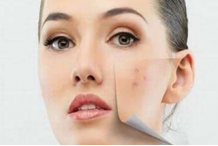 十大瘦脸方法助女性瘦成V字脸？