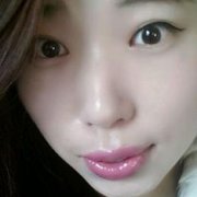 割了双眼皮 术后样子把我吓到了？