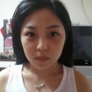 整容8个月，开始慢慢变美了？