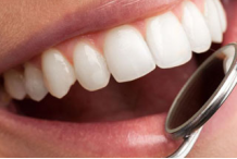 美白牙齿吃什么食物比较好？